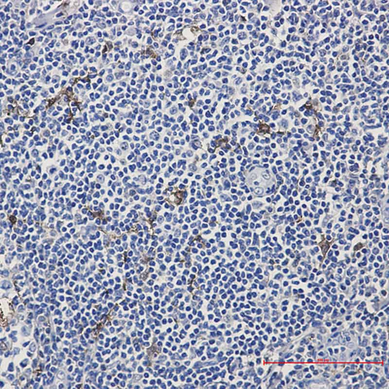 Immunohistochemistry of MERTK in paraffin-embedded Human tonsil using MERTK Rabbit mAb at dilution 1:50