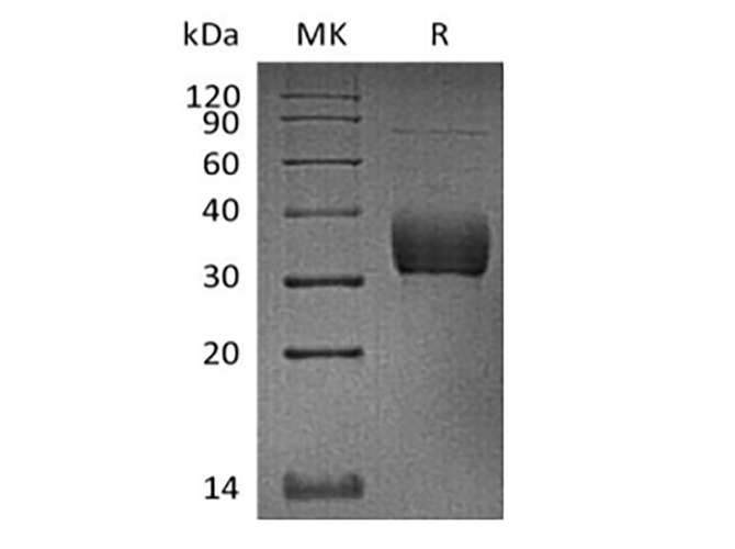 Immobilized Cynomolgus Siglec-15-His(Cat#PKSQ050096) at 2ug/ml (100 ul/well) can bind Anti-Human Siglec15 mAb. The ED50 of Anti-Human Siglec15 mAb is 125 ng/ml.