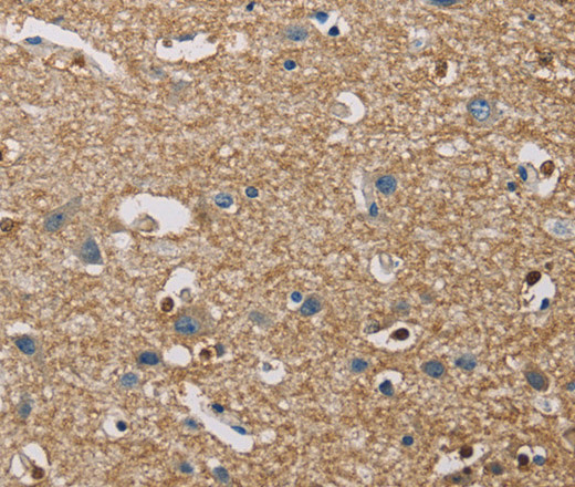 Immunohistochemistry of paraffin-embedded Human brain using PIP4K2A Polyclonal Antibody at dilution of 1:40
