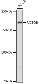 Western blot analysis of extracts of PC-12 cells using RICTOR Polyclonal Antibody at 1:500 dilution.