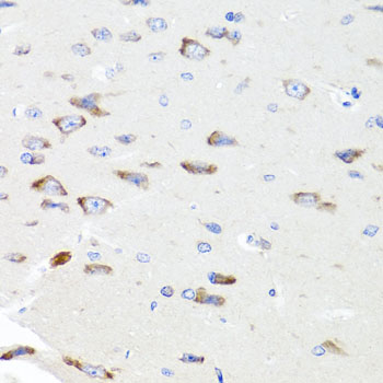 Immunohistochemistry of paraffin-embedded Rat brain using PIK3CA Polyclonal Antibody at dilution of 1:100 (40x lens).
