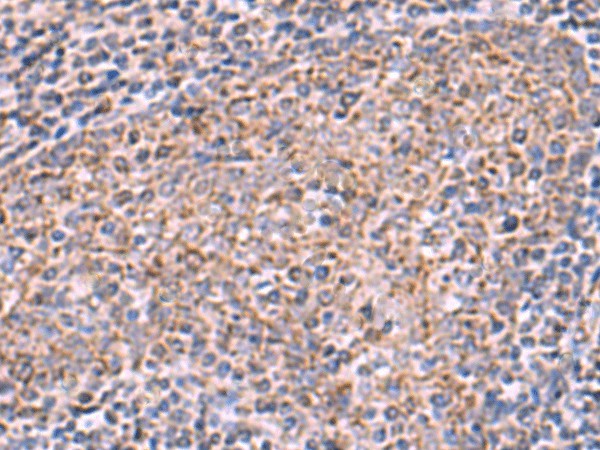 Immunohistochemistry of paraffin-embedded Human tonsil tissue  using ECSIT Polyclonal Antibody at dilution of 1:75(?200)