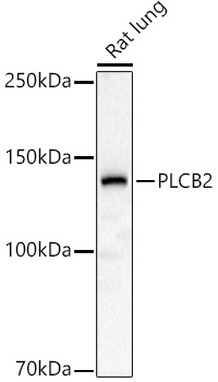 Western blot analysis of extracts of Rat lung using PLCB2 Polyclonal Antibody at 1:1000 dilution.