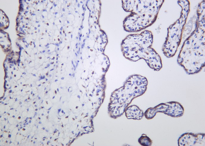 Recombinant STK3 Monoclonal Antibody - small - 2