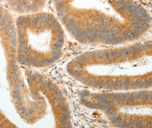 AKR1B1 Polyclonal Antibody - 2