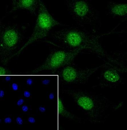 Recombinant Casein Kinase 2 beta Monoclonal Antibody - small - 4