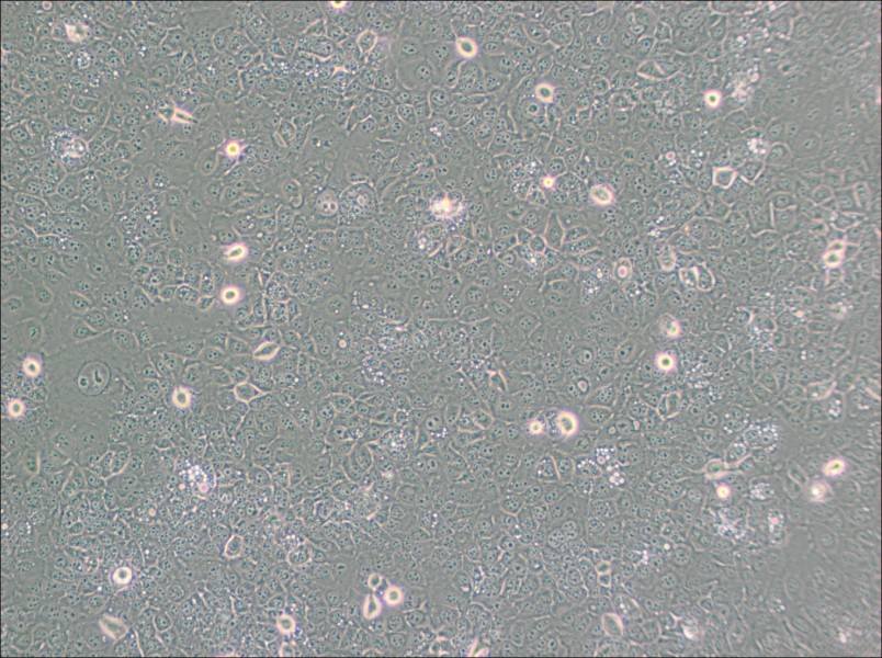 KYSE-30 Cell Complete Medium - 2