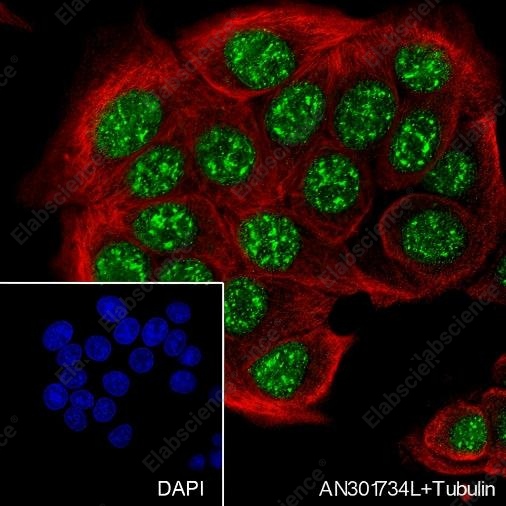 Recombinant HMGA1 Monoclonal Antibody - 2
