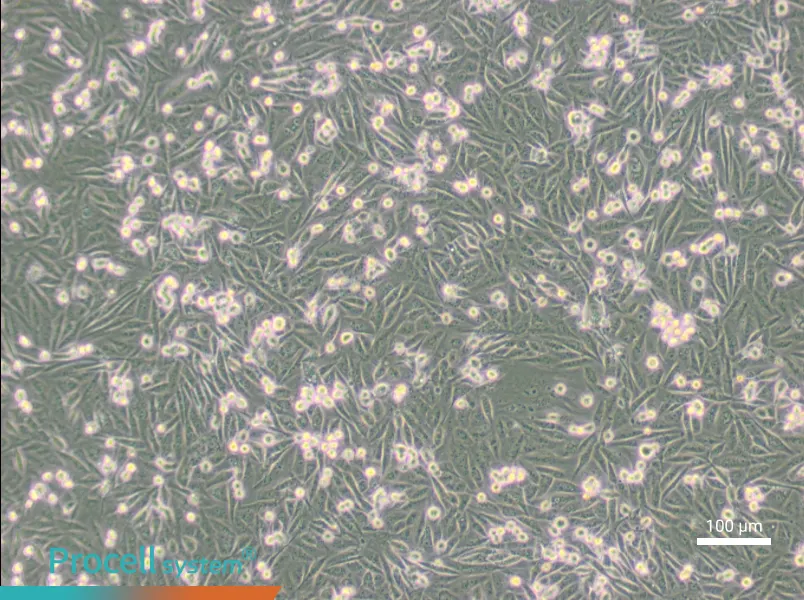MDA-MB-231-GFPMDA-MB-231-GFP - 2