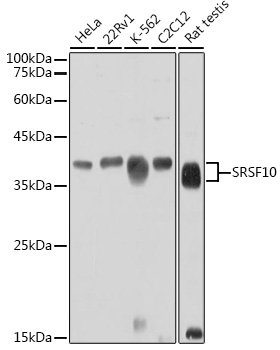 Western blot analysis of extracts of various cell lines using SRSF10 Polyclonal Antibody at 1:1000 dilution.