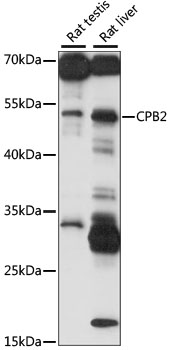 Western blot analysis of extracts of various cell lines using CPB2 Polyclonal Antibody at 1:1000 dilution.