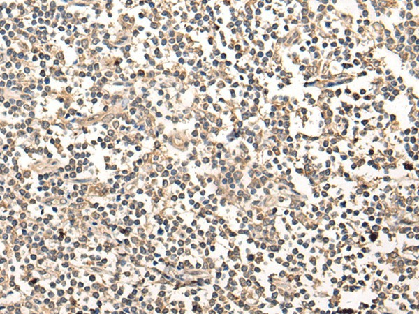 Immunohistochemistry of paraffin-embedded Human tonsil tissue  using MAGEA1 Polyclonal Antibody at dilution of 1:65(?200)