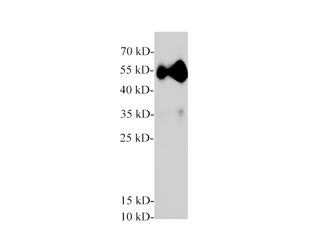 Western blot of Mouse pancreas with anti-Pancreatic lipase polyclonal antibody at 1:2000 dilution.