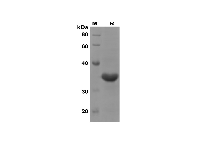 Recombinant Mouse GM-CSF Protein(His Tag)-产品推荐-1