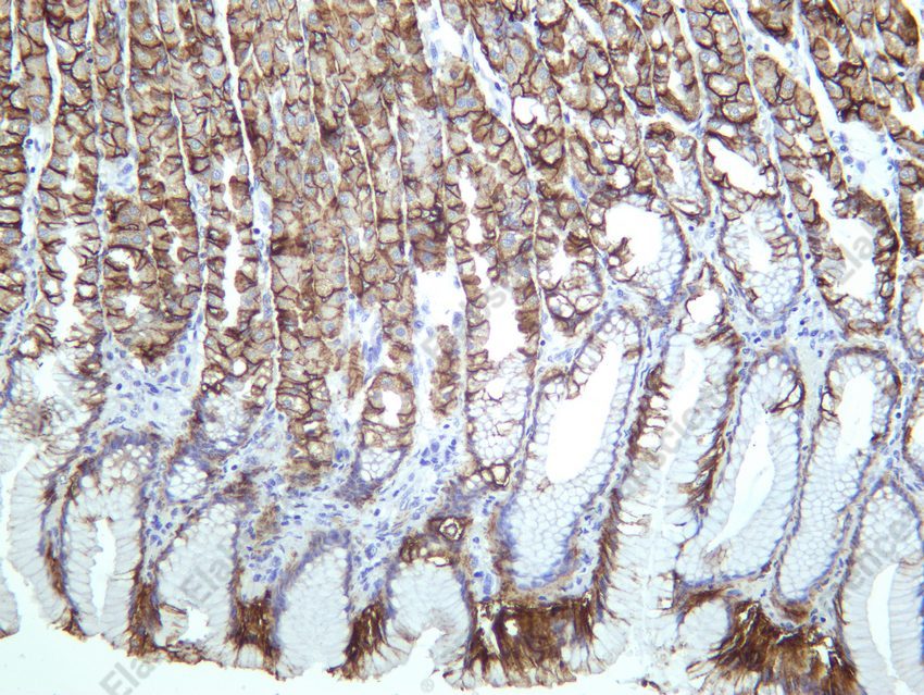 Recombinant Carbonic Anhydrase IX/CA9 Monoclonal Antibody - 5