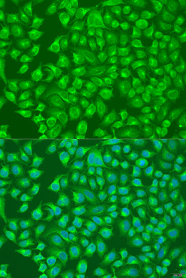 Immunofluorescence analysis of U2OS cells using SLC12A6 Polyclonal Antibody at dilution of  1:100. Blue: DAPI for nuclear staining.