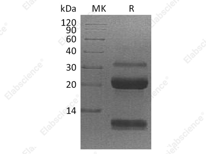Recombinant Human Kallikrein 6/KLK6 Protein (His Tag) - 1