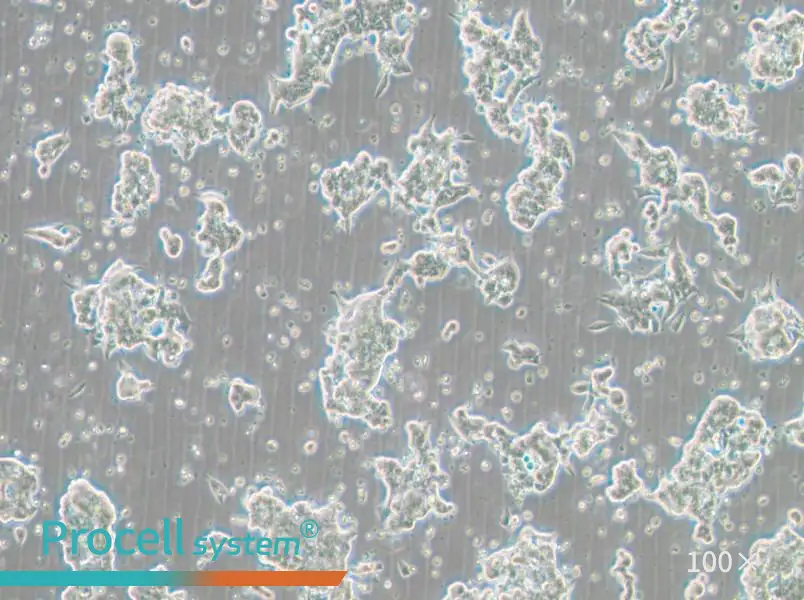 NCI-H209 [H209] Cell Complete Medium - 2