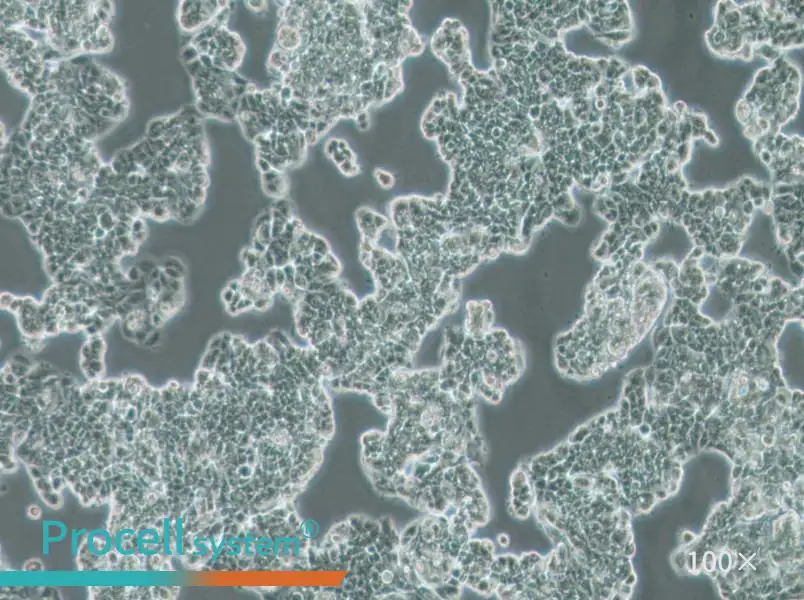 MCF7 [MCF-7] Cell Complete Medium - 1