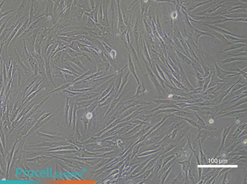 Human Oral Mucosal Fibroblast Complete Medium - 2