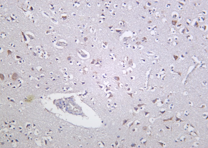 Recombinant PKD1 Monoclonal Antibody-searchlist-1
