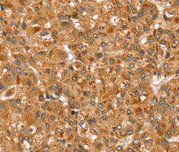 STX3 Polyclonal Antibody - 2
