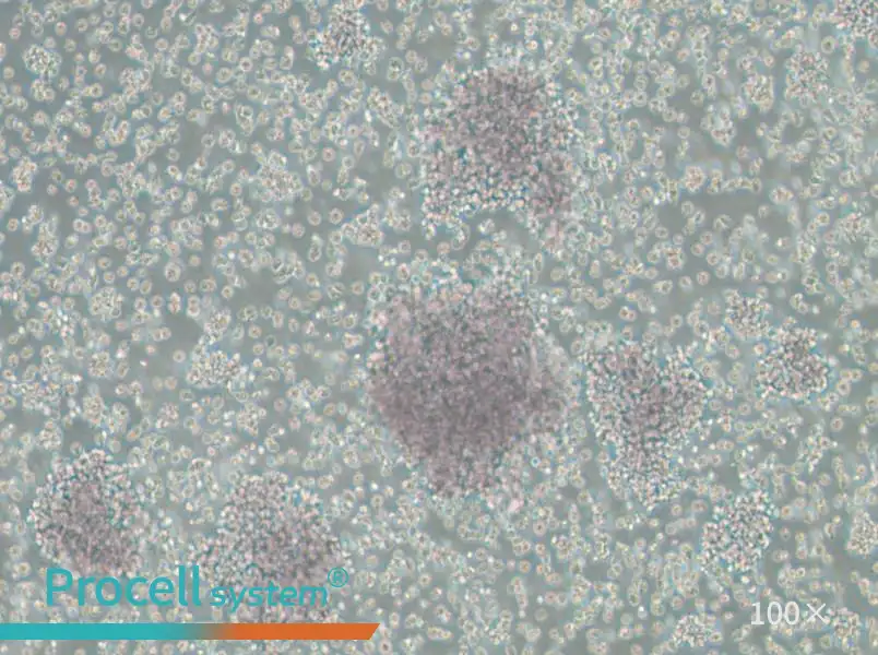 Granta-519 Cell Complete Medium - 1