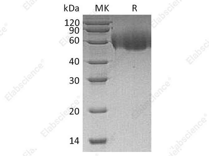 Recombinant Human CD155/PVR/NECL5 Protein (His Tag) - 1