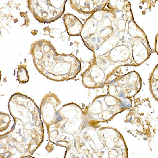 Immunohistochemistry of paraffin-embedded human placenta using CD141/Thrombomodulin Polyclonal Antibody at dilution of 1:20 (40x lens).Perform high pressure antigen retrieval with 10 mM citrate buffer pH 6.0 before commencing with IHC staining protocol.