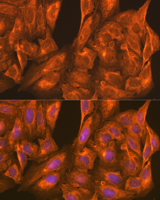 Immunofluorescence analysis of U-2 OS cells using PFKM Polyclonal antibody at dilution of 1:100 (40x lens). Blue: DAPI for nuclear staining.