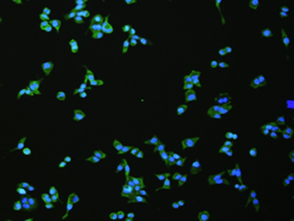 Immunofluorescence analysis of hela cell  using FLT4 Polyclonal Antibody at dilution of 1:100