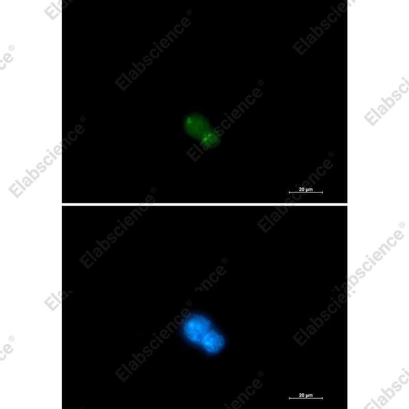 Recombinant UBA2 Monoclonal Antibody - 2