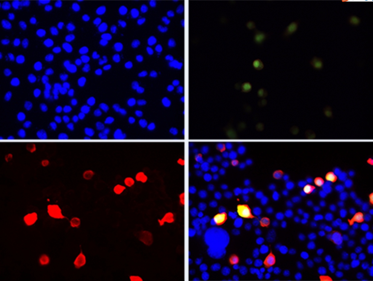 Immunofluorescent analysis of Hela cells transfected with the plasmid overexpressing Flag fusion Protein, using anti-Flag -Tag polyclonal antibody at 1:200 dilution.