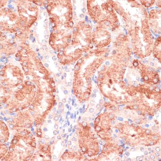 Immunohistochemistry of paraffin-embedded Rat kidney using RPIA Polyclonal Antibody at dilution of 1:100 (40x lens).
