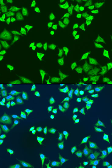 Immunofluorescence analysis of U2OS cells using SMN2 Polyclonal Antibody at dilution of 1:100. Blue: DAPI for nuclear staining.