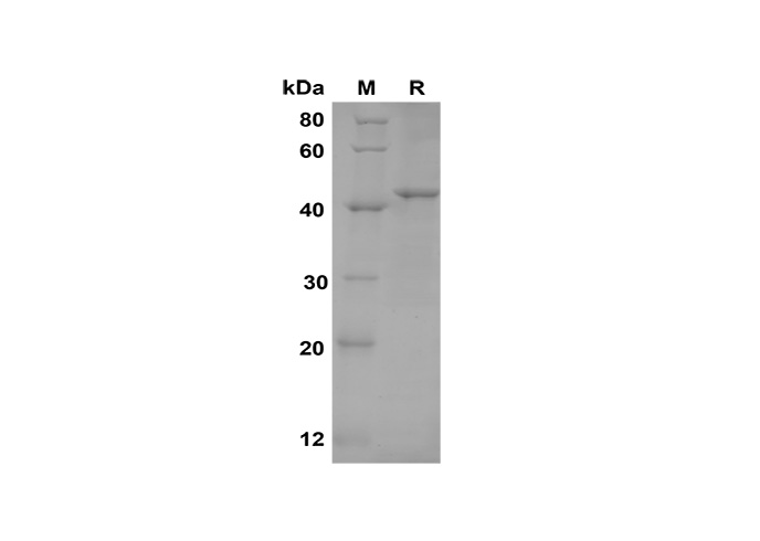 Recombinant Human Collagen alpha-1(I)chain/COL1A1 Protein(TRX,His Tag)-产品推荐-1