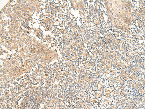 Immunohistochemistry of paraffin-embedded Human tonsil tissue  using PTGDR2 Polyclonal Antibody at dilution of 1:30(?200)