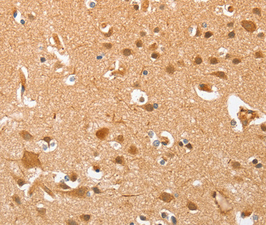 Immunohistochemistry of paraffin-embedded Human brain  using AHSG Polyclonal Antibody at dilution of 1:60