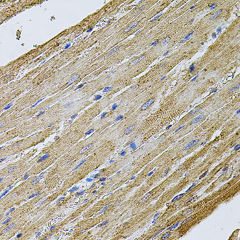 Immunohistochemistry of paraffin-embedded Rat heart using CDH16 Polyclonal Antibody at dilution of 1:100 (40x lens).