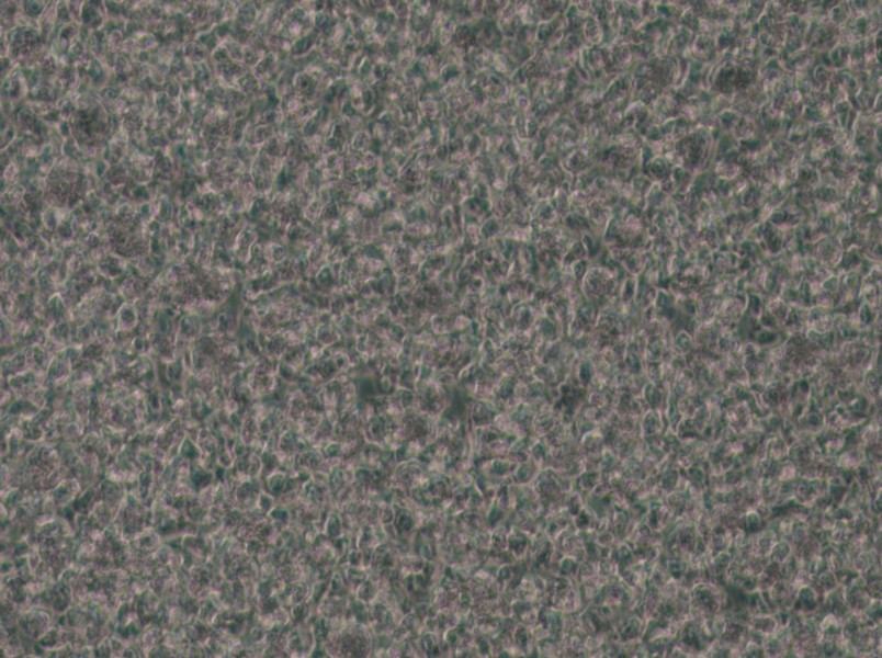 SU-DHL-1 Cell Complete Medium - small - 4