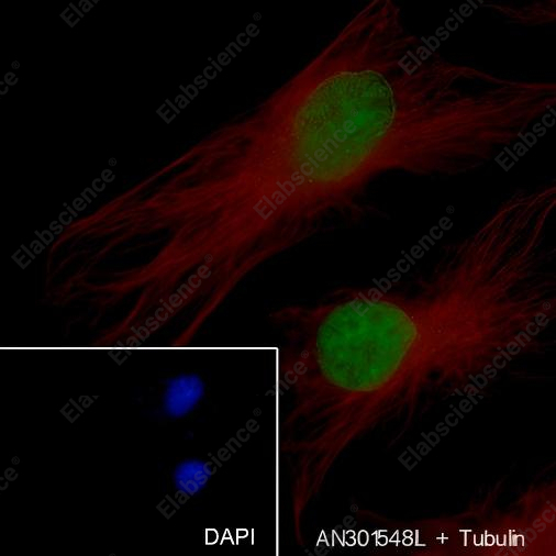 Recombinant Histone H1 (CT) Monoclonal Antibody - 4