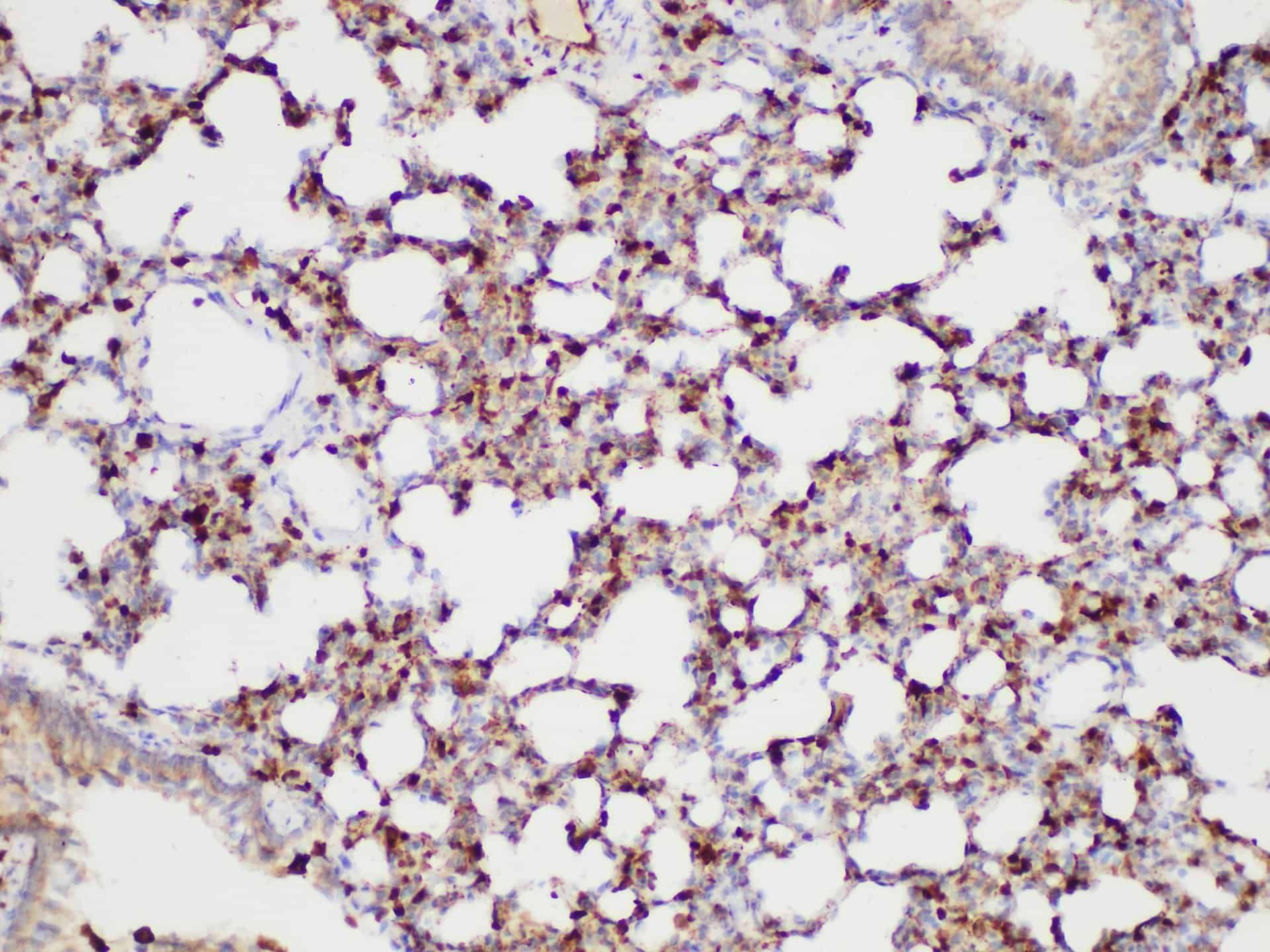 Immunohistochemistry of paraffin-embedded Rat lung using S100A4 Polycloanl Antibody at dilution of 1:50.