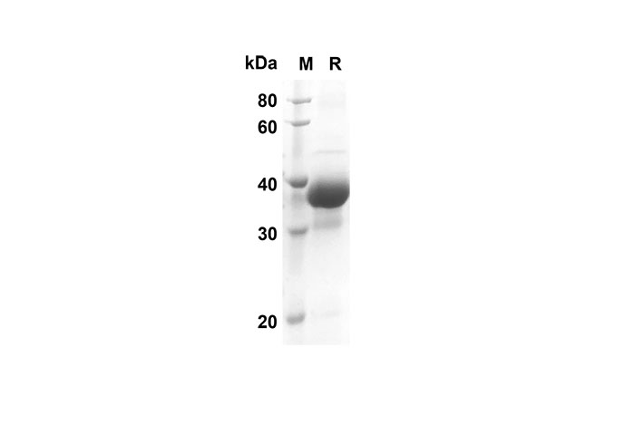 Recombinant Mouse IL-5 Protein(Fc Tag)-产品推荐-1