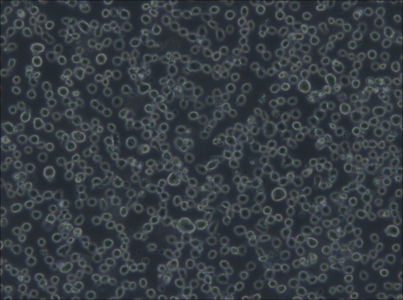 Karpas-299 Cell Complete Medium - 4