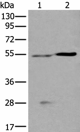 Western blot analysis of Human left kidney tissue and Human fetal liver tissue lysates  using DDC Polyclonal Antibody at dilution of 1:400