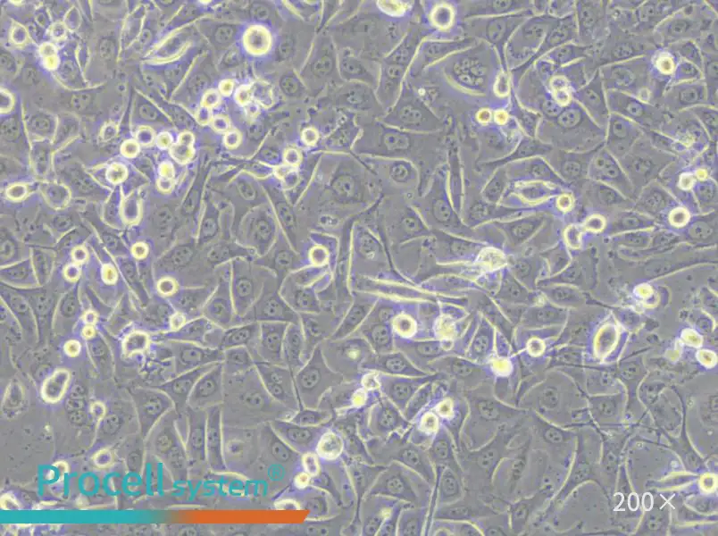 MKN1 Cell Complete Medium - small - 6