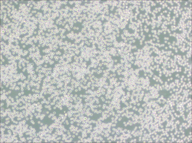 SU-DHL-4 Cell Complete MediumSU-DHL-4 Cell Complete Medium - 3