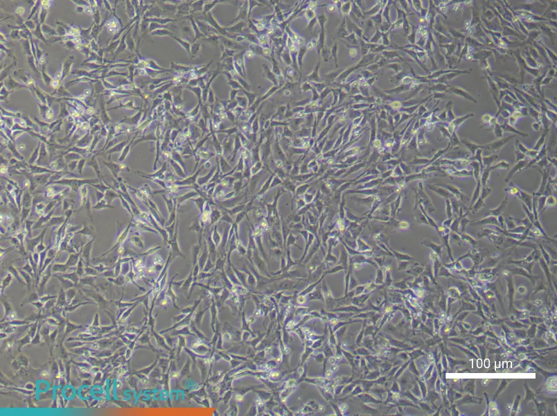 Rat Corpus Cavernosum Smooth Muscle CellsRat Corpus Cavernosum Smooth Muscle Cells - 3