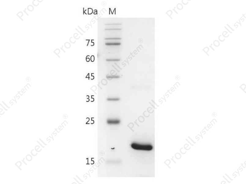 IL-17B/Zcyto, Mouse, Recombinant