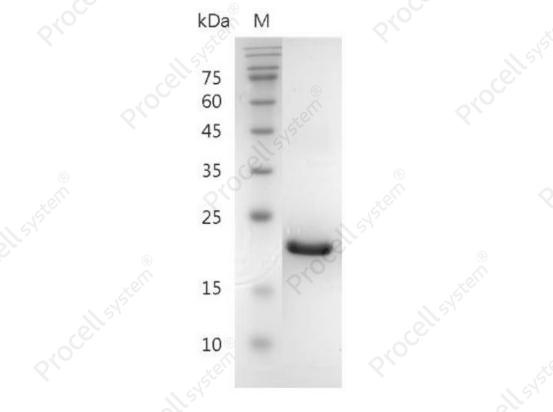 G-CSF/CSF-3/MGI-1G/pluripoietin, Mouse, Recombinant